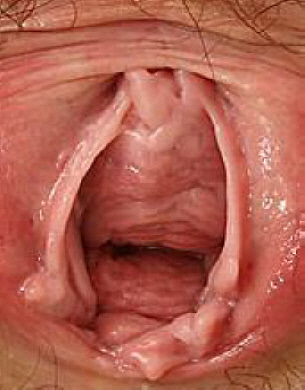 Penis Inside Vagina Igfap